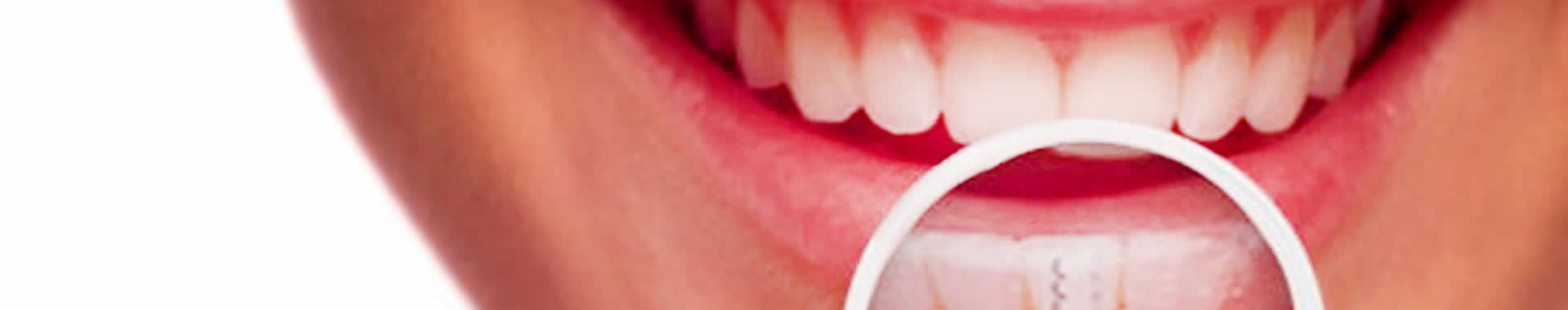 M&egrave;mento style.